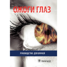 Ожоги глаз. Руководство для врачей