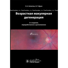 Возрастная макулярная дегенерация